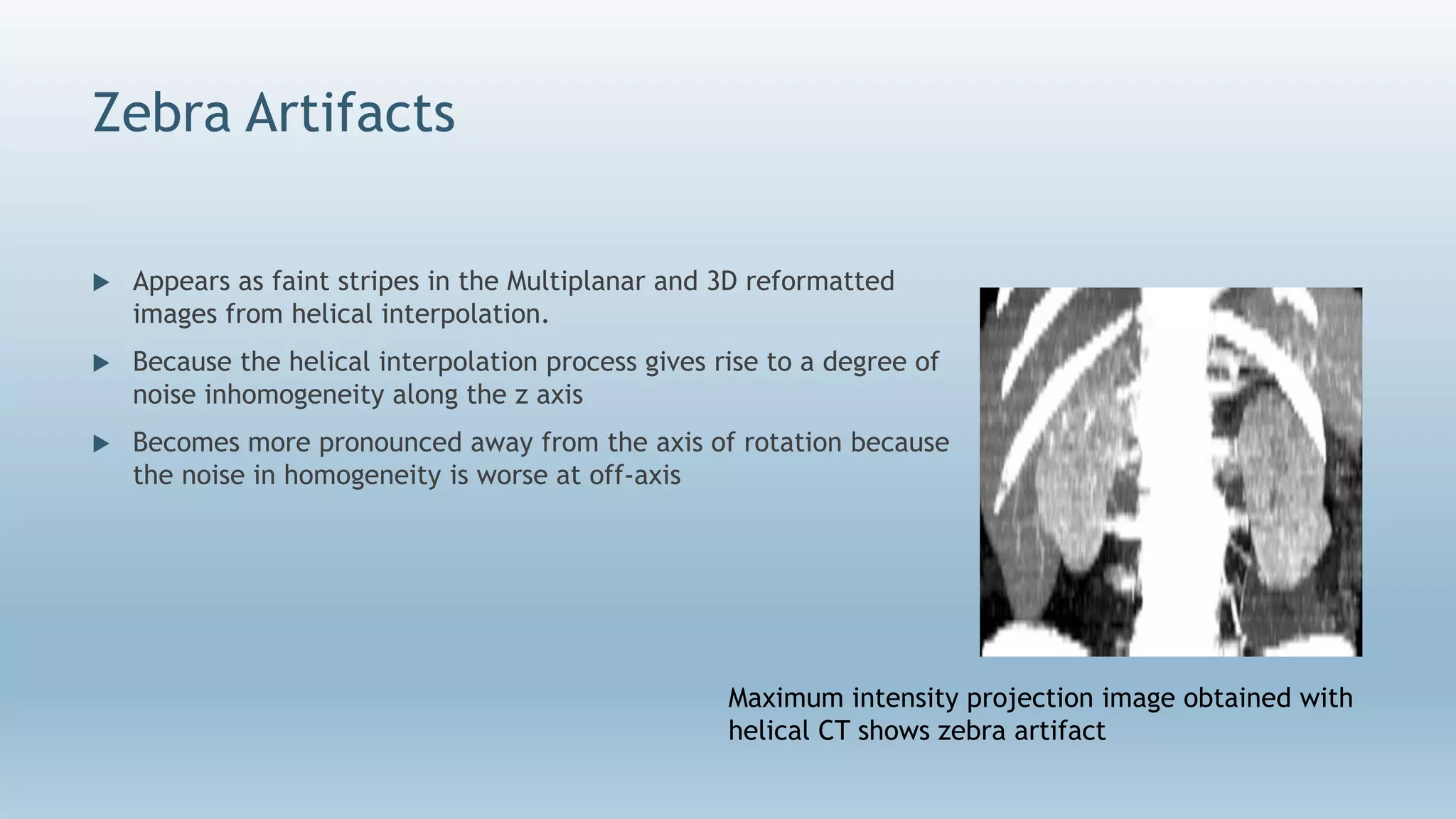 Zebra Artifacts
 Appears as faint stripes in the Multiplanar and 3D reformatted
images from helical interpolation.
 Because the helical interpolation process gives rise to a degree of
noise inhomogeneity along the z axis
 Becomes more pronounced away from the axis of rotation because
the noise in homogeneity is worse at off-axis
Maximum intensity projection image obtained with
helical CT shows zebra artifact
 