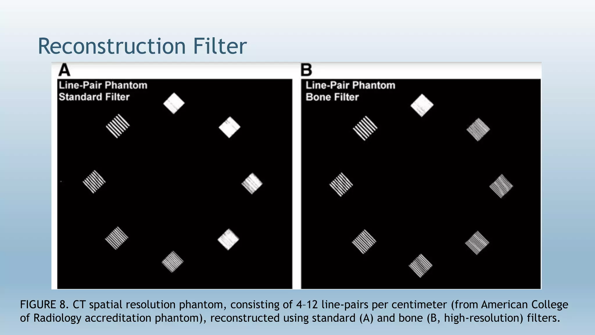 Reconstruction Filter
FIGURE 8. CT spatial resolution phantom, consisting of 4–12 line-pairs per centimeter (from American College
of Radiology accreditation phantom), reconstructed using standard (A) and bone (B, high-resolution) filters.
 