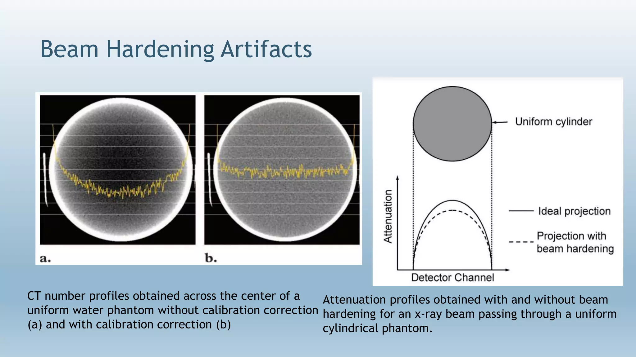 Beam Hardening Artifacts
CT number profiles obtained across the center of a
uniform water phantom without calibration correction
(a) and with calibration correction (b)
Attenuation profiles obtained with and without beam
hardening for an x-ray beam passing through a uniform
cylindrical phantom.
 