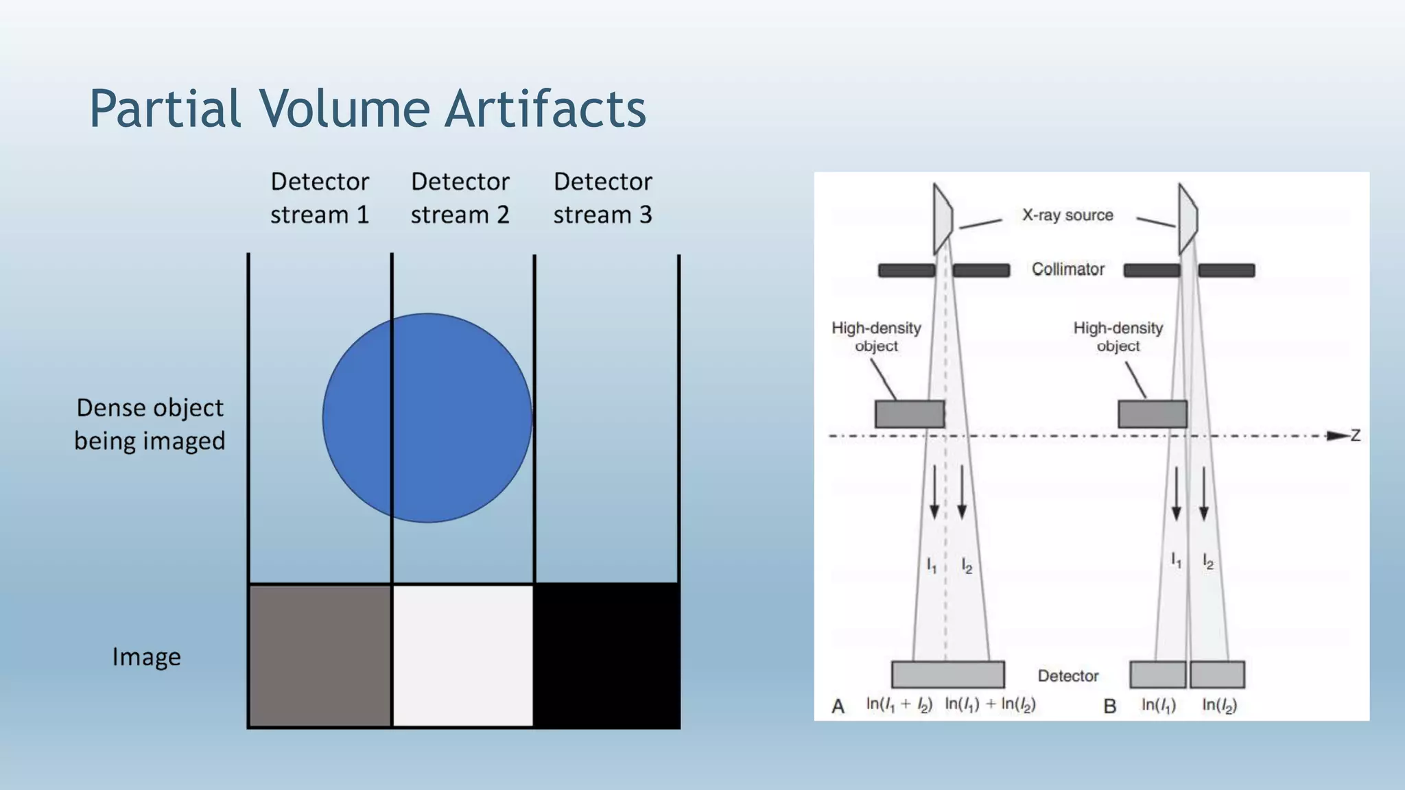 Partial Volume Artifacts
 