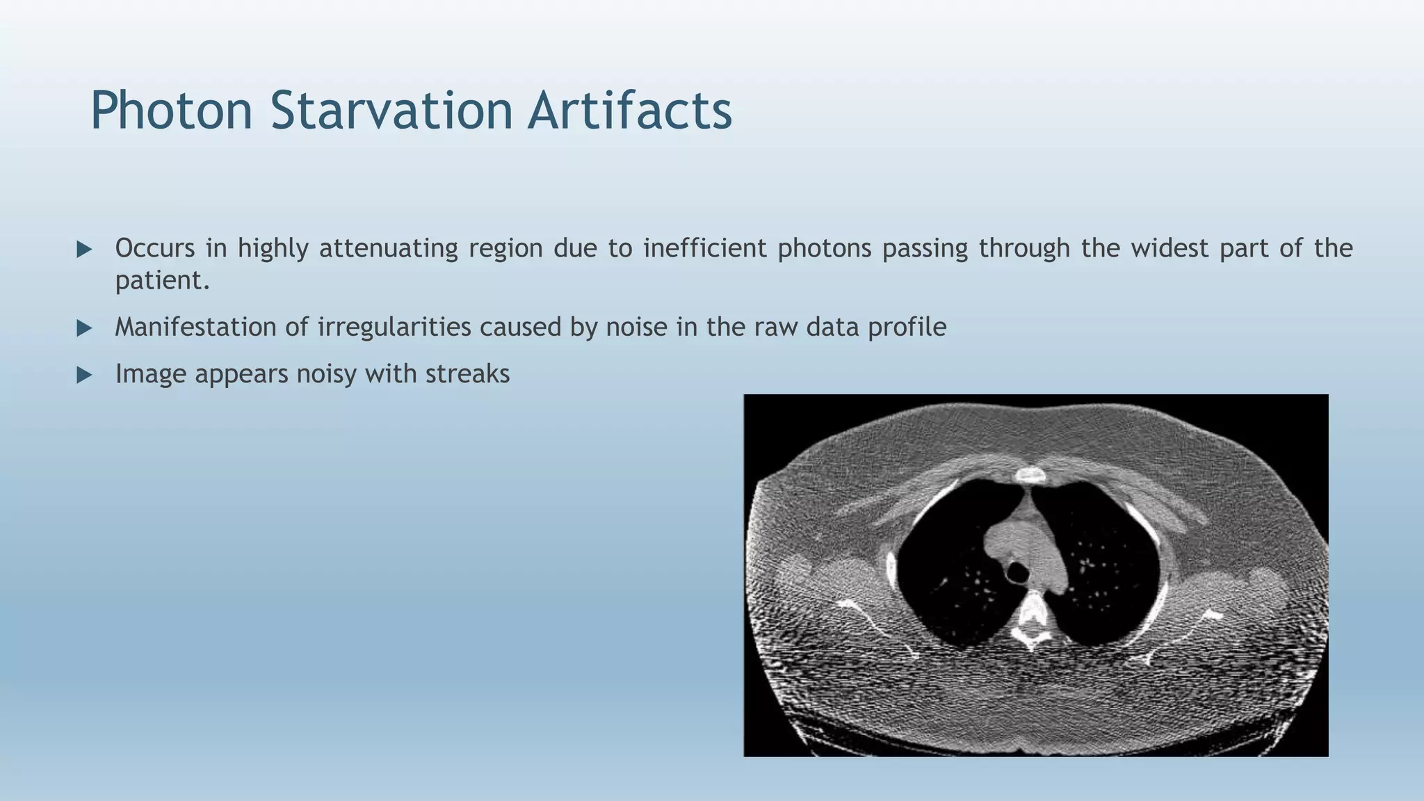 Photon Starvation Artifacts
 Occurs in highly attenuating region due to inefficient photons passing through the widest part of the
patient.
 Manifestation of irregularities caused by noise in the raw data profile
 Image appears noisy with streaks
 