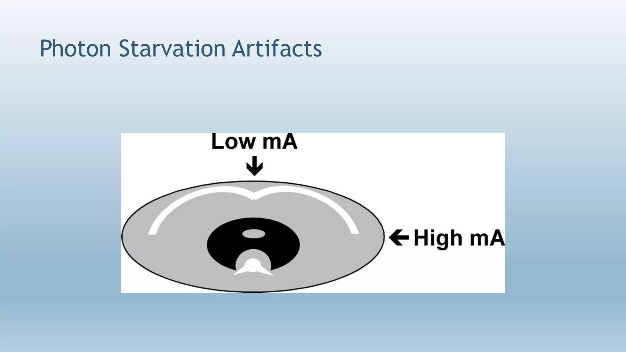 Photon Starvation Artifacts
 