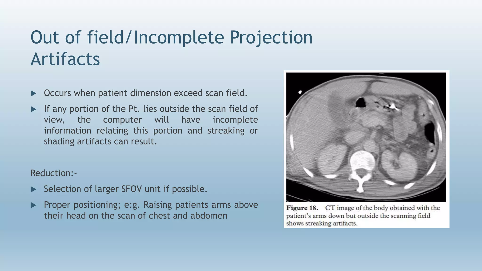 Out of field/Incomplete Projection
Artifacts
 Occurs when patient dimension exceed scan field.
 If any portion of the Pt. lies outside the scan field of
view, the computer will have incomplete
information relating this portion and streaking or
shading artifacts can result.
Reduction:-
 Selection of larger SFOV unit if possible.
 Proper positioning; e:g. Raising patients arms above
their head on the scan of chest and abdomen
 