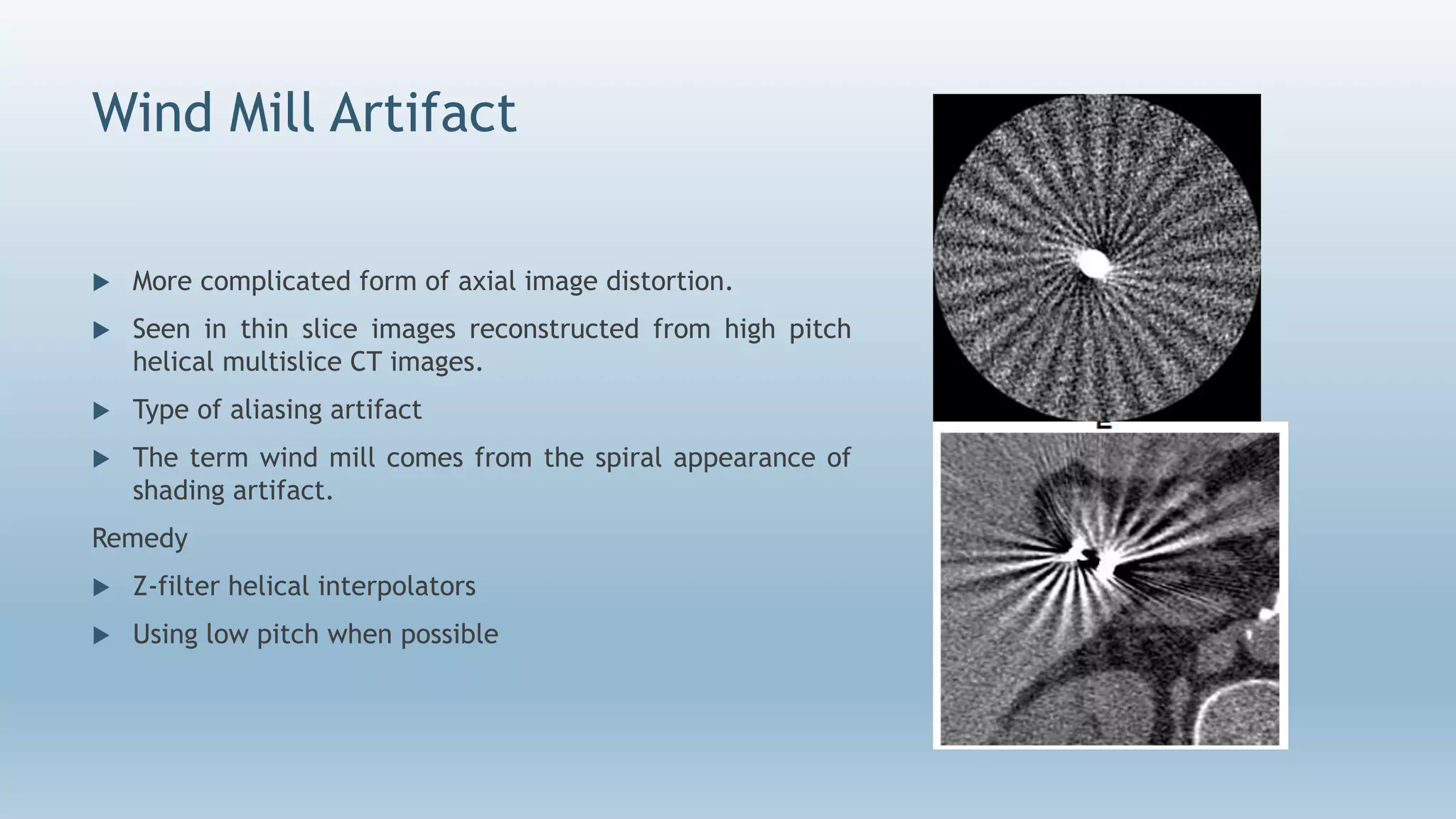 Wind Mill Artifact
 More complicated form of axial image distortion.
 Seen in thin slice images reconstructed from high pitch
helical multislice CT images.
 Type of aliasing artifact
 The term wind mill comes from the spiral appearance of
shading artifact.
Remedy
 Z-filter helical interpolators
 Using low pitch when possible
 