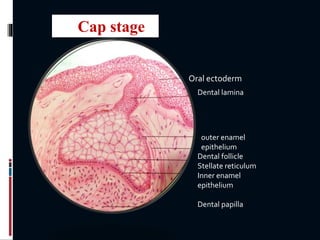 Oral ectoderm
Dental lamina
outer enamel
epithelium
Dental follicle
Stellate reticulum
Inner enamel
epithelium
Dental papilla
Cap stage
 