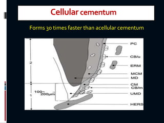 Cellular cementum
Forms 30 times faster than acellular cementum
 