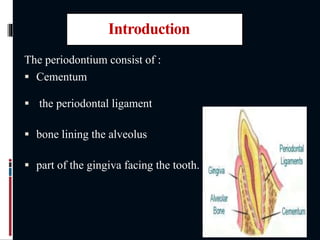 Introduction
The periodontium consist of :
 Cementum
 the periodontal ligament
 bone lining the alveolus
 part of the gingiva facing the tooth.
 
