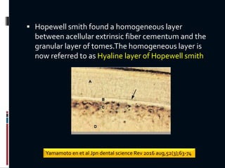  Hopewell smith found a homogeneous layer
between acellular extrinsic fiber cementum and the
granular layer of tomes.The homogeneous layer is
now referred to as Hyaline layer of Hopewell smith
Yamamoto en et al Jpn dental science Rev 2016 aug,52(3);63-74
 