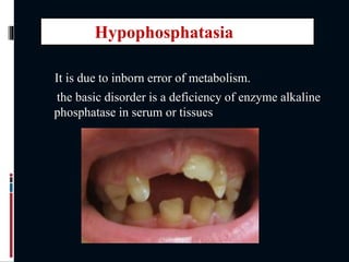 It is due to inborn error of metabolism.
the basic disorder is a deficiency of enzyme alkaline
phosphatase in serum or tissues
Hypophosphatasia
 