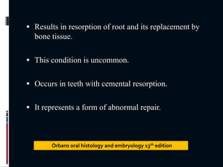  Results in resorption of root and its replacement by
bone tissue.
 This condition is uncommon.
 Occurs in teeth with cemental resorption.
 It represents a form of abnormal repair.
Òrbans oral histology and embryology 13th edition
 