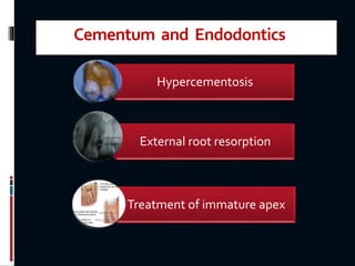 Cementum and Endodontics
Hypercementosis
External root resorption
Treatment of immature apex
 