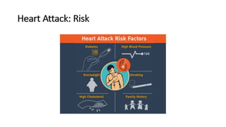 Comprehensive Visual Guide to Heart Attack and Cardiothoracic Vascular ...