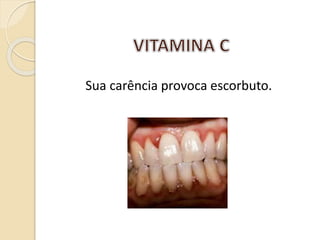Sua carência provoca escorbuto.
 