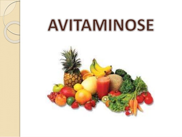 Avitaminose: Symptômes Et Traitement – JQMCLV