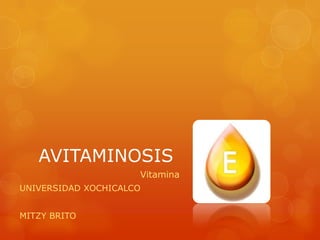 AVITAMINOSIS
Vitamina
UNIVERSIDAD XOCHICALCO
MITZY BRITO

 