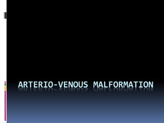 ARTERIO-VENOUS MALFORMATION
 