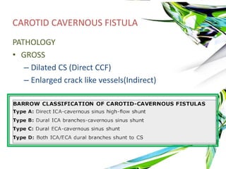 Vascular Malformations Of CNS Radiology | PPTX
