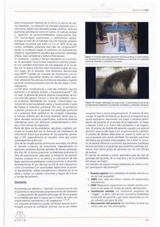 Otra complicación habitual de la VM es la ruptura de sep-
tos alveolares. La utilización de elevadas presiones pico o
volúmenes tidales muy elevados puede conllevar, tanto en
pulmones patológicos como en sanos, la ruptura alveolar
y aparición de pneumomediastino, pneumotórax (Fig.
17), hemorragias pulmonares y embolismos aéreos.
Aunque se trata de un hallazgo con una marcada variación
individual, se estima que entre un 3 y un 40% de los pa-
cientes ventilados presentan este tipo de cornplicación-"
siendo su incidencia mayor en pacientes con pulmones pa-
tológicos, especialmente aquellos que presentan patologías
difusas, baja complianza o bullas enfisematosas.
En ocasiones, cuando el tiempo espiratorio es insuficien-
te, el ventilador inicia la fase inspiratoria estando presen-
te una cantidad importante de aire atrapado en la vía aé-
rea con lo que el volumen tidal resultante puede ser mu-
cho mayor de lo deseado. Este fenómeno denominado
auto-PEEp2
,5,6 puede ser causante de volutrauma y es es-
pecialmente importante tenerlo en cuenta cuando esta-
mos utilizando frecuencias ventilatorias elevadas y nuestro
paciente presenta procesos crónicos de vías bajas o bron-
coespasmo.
La VM tiene consecuencias a nivel del endotelio vascular
pulmonar y el epitelio alveolar y traqueobronquial-". Por
un lado, la génesis de presión positiva intraalveolar de for-
ma reiterada genera tracción a nivel del endotelio vascu-
lar pulmonar debilitando las uniones intercelulares, au-
mentando la permeabilidad capilar y favoreciendo el paso
de fluidos al intersticio pulmonar. Por otro, la ventilación
a presión positiva en el paciente con patología pulmonar
va a ocasionar daño epitelial en las unidades colapsadas,
al reclutar alvéolos que de forma reiterada tienen que su-
perar elevadas tensiones superficiales, existiendo alvéolos
Colindantes sanos con diferente comportamiento y tiem-
pos o frecuencias de expansión.
Parte del daño en los endotelios vasculares y epitelio pul-
monar es ocasionado por la liberación de mediadores de
inflamación 6,8,9 que acontece en los pacientes someti-
dos a VM, especialmente en aquellos casos que sufren
sobreexpansión pulmonar.
Otra de las complicaciones pulmonares asociadas a la VM es
la elevada incidencia de pneumonía, especialmente en
pacientes ventilados durante periodos de tiempo prolonga-
dos (Fig.18). El éstasis posicional, la atelectasia pulmonar, la
falta de expectoración adecuada, la utilización de procedi-
mientos invasivos en la vía aérea y la colonización de vías
bajas respiratorias predispone a estos pacientes al desarrollo
de pneumonías. Espor ello que resulta de vital importancia,
como comentamos con anterioridad, reposicionar al pacien-
te regularmente, utilizar procedimientos asépticos en la vía
aérea y realizar un cuidado meticuloso y regular de la boca
y faringe del paciente.
Destete
Se entiende por destete o "weaning" el proceso por el cual
el paciente es desconectado progresivamente del ventilador
31. La desconexión del paciente tiene lugar de forma gradual
en la medida que éste es capaz, por sí mismo, de cubrir sus
requerimientos ventilatorios y de oxigenación 2,5.6,8,32
Los músculos ventilatorios pueden atrofiarse durante el pro-
longado proceso de ventilación artificial, con lo que deben
¿]D
A.V. E. P.A. 241
Vol. 25, n° 4, 2005
Figura 17. Cámara triple para aspiración torácica continua. El pneumotórax
por barotrauma es una complicación habitual en el paciente con patología
pulmonar sometido a ventilación mecánica.
"
Figura 18. Imagen radiológica de pneumonía. La pneumonia es una de las
complicaciones habituales en pacientes sometidos a ventilación mecánica.
recuperar tono y fuerza progresivamente. El objetivo de inte-
rrumpir el soporte ventilatorio es disminuir la magnitud de la
ayuda respiratoria, requiriendo una mayor y creciente partici-
pación del paciente en el proceso de la respiración, sin llegar
a exponer a éste a un nuevo fallo ventilatorio o de oxigena-
ción. El proceso de destete del paciente requiere una especial
atención, pues puede llegar a ser un proceso lento y gradual.
El proceso de destete debe tener en cuenta la razón por la
que el paciente esta siendo ventilado. Por ejemplo, pacientes
ventilados por procesos intracraneales, van a tener un proce-
so de destete diferente a pacientes que presentan patologías
neuromusculares o a pacientes que presentan patología pul-
monar. Este último grupo de pacientes son los más difíciles
de evaluar.
El método de destete a utilizar dependerá pues del tipo de
patología del paciente, de su respuesta y de las posibilidades
del propio ventilador.
Los métodos de desete incluyen (ordenados de menor a ma-
yor participación del pacienter-":
1. Presión soporte (con cantidades de presión soporte ca-
da vez más pequeñas).
2. SIMV (con cada vez menor número de respiraciones
mandatarias).
3. (PAP (Respiración espontánea con presión positiva con-
tinua en vía aérea con niveles de presión decrecientes).
4. Ventilación asistida con incremento progresivo del
"trigger", es decir, cada vez con una menor sensibilidad
al esfuerzo del paciente y por tanto requiriendo un ma-
yor esfuerzo por parte de éste.
5. Desconexión del paciente del ventilador durante pe-
riodos cada vez más prolongados.
 