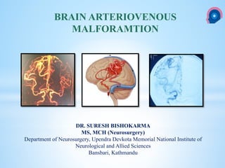 cka
DR. SURESH BISHOKARMA
MS, MCH (Neurosurgery)
Department of Neurosurgery, Upendra Devkota Memorial National Institute of
Neurological and Allied Sciences
Bansbari, Kathmandu
BRAIN ARTERIOVENOUS
MALFORAMTION
 