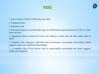 1. Flow void on T1WIor T2WIwithin the AVM
2. Feeding arteries
3. Draining veins
4. Increased intensity on partial flip-angle (to differentiate signal dropout on T1WI or T2WI
from calcium)
5. Significant edema around the lesion may indicate a tumor that has bled rather than an
AVM
6. Gradient echo sequences (GRASS) help demonstrate surrounding hemosiderin which
suggests a previous significant hemorrhage
7. A complete ring of low density (due to hemosiderin) surrounding the lesion suggests
AVM over neoplasm
MRI
 