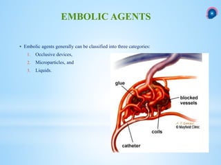  Embolic agents generally can be classified into three categories:
1. Occlusive devices,
2. Microparticles, and
3. Liquids.
EMBOLIC AGENTS
 