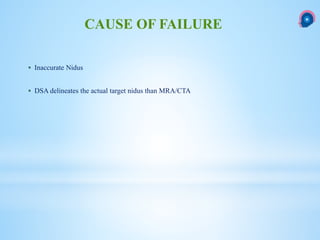  Inaccurate Nidus
 DSA delineates the actual target nidus than MRA/CTA
CAUSE OF FAILURE
 