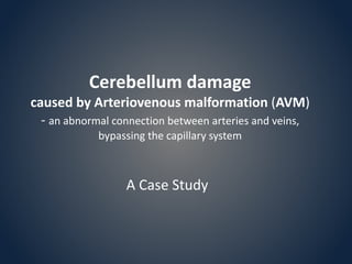 Cerebellum damage
caused by Arteriovenous malformation (AVM)
- an abnormal connection between arteries and veins,
bypassing the capillary system
A Case Study
 