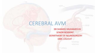 CEREBRAL AVM
DR SHAMEEJ MUHAMED KV
SENIOR RESIDENT
DEPARTMENT OF NEUROSURGERY
GMC ,CALICUT
 
