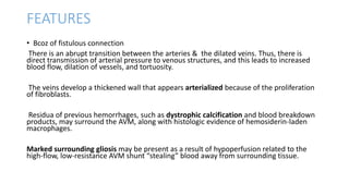 FEATURES
• Bcoz of fistulous connection
There is an abrupt transition between the arteries & the dilated veins. Thus, there is
direct transmission of arterial pressure to venous structures, and this leads to increased
blood flow, dilation of vessels, and tortuosity.
The veins develop a thickened wall that appears arterialized because of the proliferation
of fibroblasts.
Residua of previous hemorrhages, such as dystrophic calcification and blood breakdown
products, may surround the AVM, along with histologic evidence of hemosiderin-laden
macrophages.
Marked surrounding gliosis may be present as a result of hypoperfusion related to the
high-flow, low-resistance AVM shunt “stealing” blood away from surrounding tissue.
 