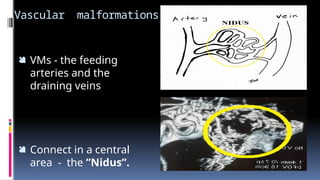 Vascular Rarea Vascular malformations of the head and neck surgical perspective Prof ...