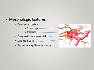 • Morphologic features
• Feeding arteries
» En passage
» Terminal
• Dysplastic vascular nidus
• Draining vein
• Perinidal capillary network
 