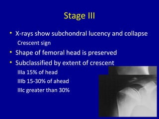 Stage III
• X-rays show subchondral lucency and collapse
Crescent sign
• Shape of femoral head is preserved
• Subclassified by extent of crescent
IIIa 15% of head
IIIb 15-30% of ahead
IIIc greater than 30%
 