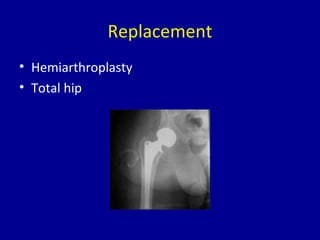 Replacement
• Hemiarthroplasty
• Total hip
 