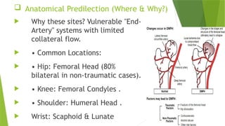 Comprehensive Overview of Avascular Necrosis (AVN): Causes, Diagnosis ...