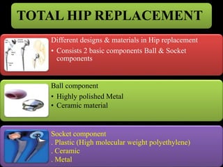 TOTAL HIP REPLACEMENT 
Different designs & materials in Hip replacement 
• Consists 2 basic components Ball & Socket 
comp...