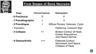 Management of Avascular Necrosis of femoral head at Pre-Collapse stage ...