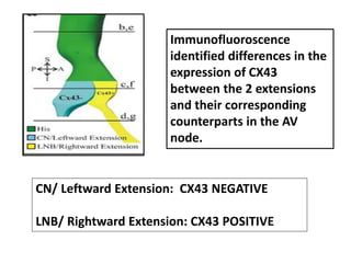 Immunofluoroscence
identified differences in the
expression of CX43
between the 2 extensions
and their corresponding
counterparts in the AV
node.
CN/ Leftward Extension: CX43 NEGATIVE
LNB/ Rightward Extension: CX43 POSITIVE
 