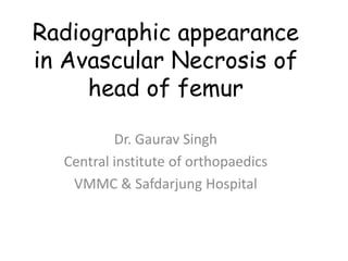 Radiographic appearance
in Avascular Necrosis of
head of femur
Dr. Gaurav Singh
Central institute of orthopaedics
VMMC & Safdarjung Hospital
 