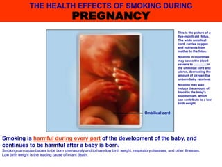 This is the picture of a
five-month old fetus.
The white umbilical
cord carries oxygen
and nutrients from
mother to the fetus.
Nicotine in cigarettes
may cause the blood
vessels to constrict in
the umbilical cord and
uterus, decreasing the
amount of oxygen the
unborn baby receives.
Nicotine may also
reduce the amount of
blood in the baby’s
bloodstream, which
can contribute to a low
birth weight.
THE HEALTH EFFECTS OF SMOKING DURING
PREGNANCY
Smoking is harmful during every part of the development of the baby, and
continues to be harmful after a baby is born.
Smoking can cause babies to be born prematurely and to have low birth weight, respiratory diseases, and other illnesses.
Low birth weight is the leading cause of infant death.
Umbilical cord
 