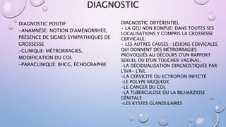 DIAGNOSTIC
DIAGNOSTIC POSITIF
-ANAMNÈSE: NOTION D'AMÉNORRHÉE,
PRÉSENCE DE SIGNES SYMPATHIQUES DE
GROSSESSE
-CLINIQUE: MÉTRORRAGIES,
MODIFICATION DU COL
-PARACLINIQUE: BHCG, ÉCHOGRAPHIE
DIAGNOSTIC DIFFÉRENTIEL
• LA GEU NON ROMPUE: DANS TOUTES SES
LOCALISATIONS Y COMPRIS LA GROSSESSE
CERVICALE.
• LES AUTRES CAUSES : LÉSIONS CERVICALES
QUI DONNENT DES MÉTRORRAGIES
PROVOQUÉS AU DÉCOURS D'UN RAPPORT
SEXUEL OU D'UN TOUCHER VAGINAL.
-LA DÉCIDUALISATION DIAGNOSTIQUÉE PAR
L'IVA- L'IVL
-LA CERVICITE OU ECTROPION INFECTÉ
-LE POLYPE MUQUEUX
-LE CANCER DU COL
-LA TUBERCULOSE OU LA BILHARZIOSE
GÉNITALE
-LES KYSTES GLANDULAIRES
 