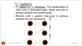 A v pattern by ankit | PPTX