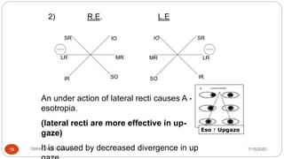 2) R.E. L.E
An under action of lateral recti causes A -
esotropia.
(lateral recti are more effective in up-
gaze)
It is caused by decreased divergence in up
SR SRIO IO
MRMR LR
IR IRSOSO
LR
Eso ↑ Upgaze
7/15/2020Optom. Ankit varshney18
 