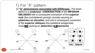 1) For “A” pattern
(i) “A” phenomenon associated with ESOtropia:- The basic
defect is a weakness  UNDERACTION of the INFERIOR
OBLIQUES with a consequent overaction of the superior
recti (the contralateral synergic muscle) causing an
adduction on elevation, and with a consequent overaction
of the superior obliques (the ipsilateral antagonistic
muscles) causing an abduction on depression.
Eso ↑ Upgaze
LR LRMR MR
IO IO
SO SO
SR SR
IR IR
RE LE
7/15/2020Optom. Ankit varshney24
 