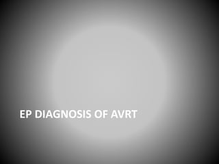 EP DIAGNOSIS OF AVRT
 