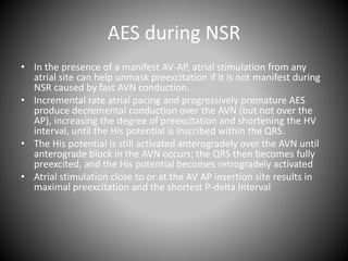 AES during NSR
• In the presence of a manifest AV-AP, atrial stimulation from any
atrial site can help unmask preexcitation if it is not manifest during
NSR caused by fast AVN conduction.
• Incremental rate atrial pacing and progressively premature AES
produce decremental conduction over the AVN (but not over the
AP), increasing the degree of preexcitation and shortening the HV
interval, until the His potential is inscribed within the QRS.
• The His potential is still activated anterogradely over the AVN until
anterograde block in the AVN occurs; the QRS then becomes fully
preexcited, and the His potential becomes retrogradely activated
• Atrial stimulation close to or at the AV AP insertion site results in
maximal preexcitation and the shortest P-delta Interval
 