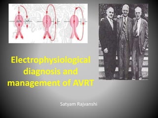 Electrophysiological
diagnosis and
management of AVRT
Satyam Rajvanshi
 
