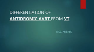 DIFFERENTIATION OF
ANTIDROMIC AVRT FROM VT
DR.G. ABISHEK
 