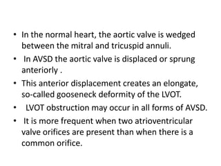 • In the normal heart, the aortic valve is wedged
  between the mitral and tricuspid annuli.
• In AVSD the aortic valve is displaced or sprung
  anteriorly .
• This anterior displacement creates an elongate,
  so-called gooseneck deformity of the LVOT.
• LVOT obstruction may occur in all forms of AVSD.
• It is more frequent when two atrioventricular
  valve orifices are present than when there is a
  common orifice.
 