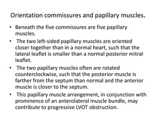 Orientation commissures and papillary muscles.
• Beneath the five commissures are five papillary
  muscles.
• The two left-sided papillary muscles are oriented
  closer together than in a normal heart, such that the
  lateral leaflet is smaller than a normal posterior mitral
  leaflet.
• The two papillary muscles often are rotated
  counterclockwise, such that the posterior muscle is
  farther from the septum than normal and the anterior
  muscle is closer to the septum.
• This papillary muscle arrangement, in conjunction with
  prominence of an anterolateral muscle bundle, may
  contribute to progressive LVOT obstruction.
 
