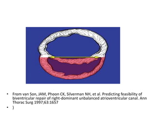 • From van Son, JAM, Phoon CK, Silverman NH, et al. Predicting feasibility of
  biventricular repair of right-dominant unbalanced atrioventricular canal. Ann
  Thorac Surg 1997;63:1657
• )
 